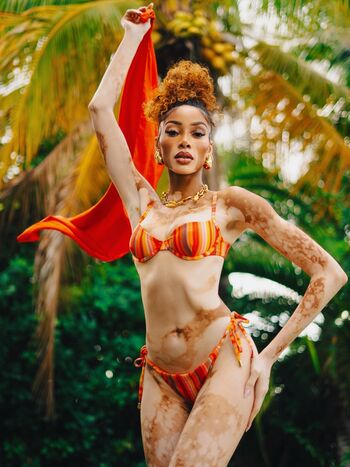 Winnie Harlow